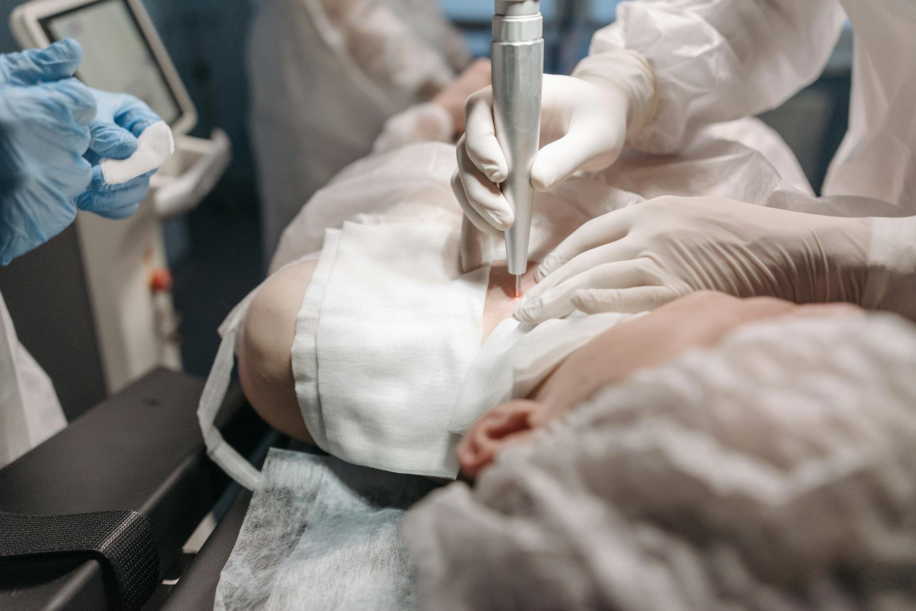 Láser Vascular en Clínica Gottardo